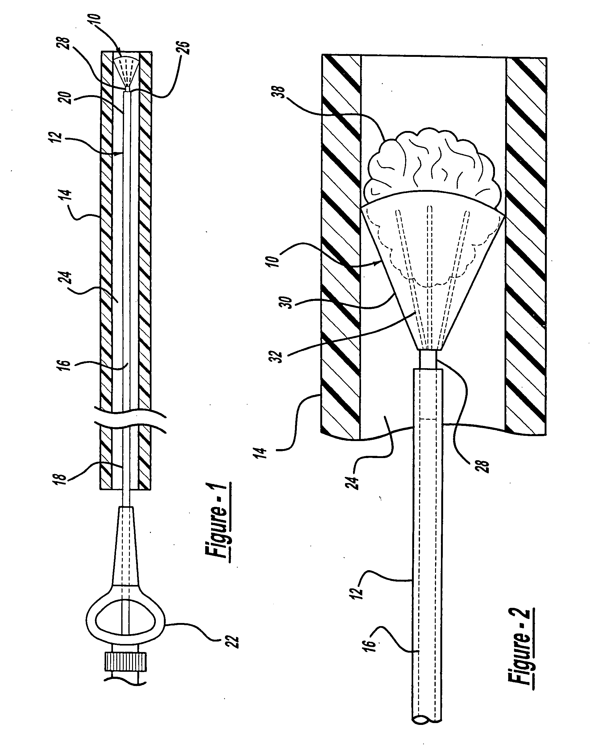 Aneurysm embolic device with an occlusive member