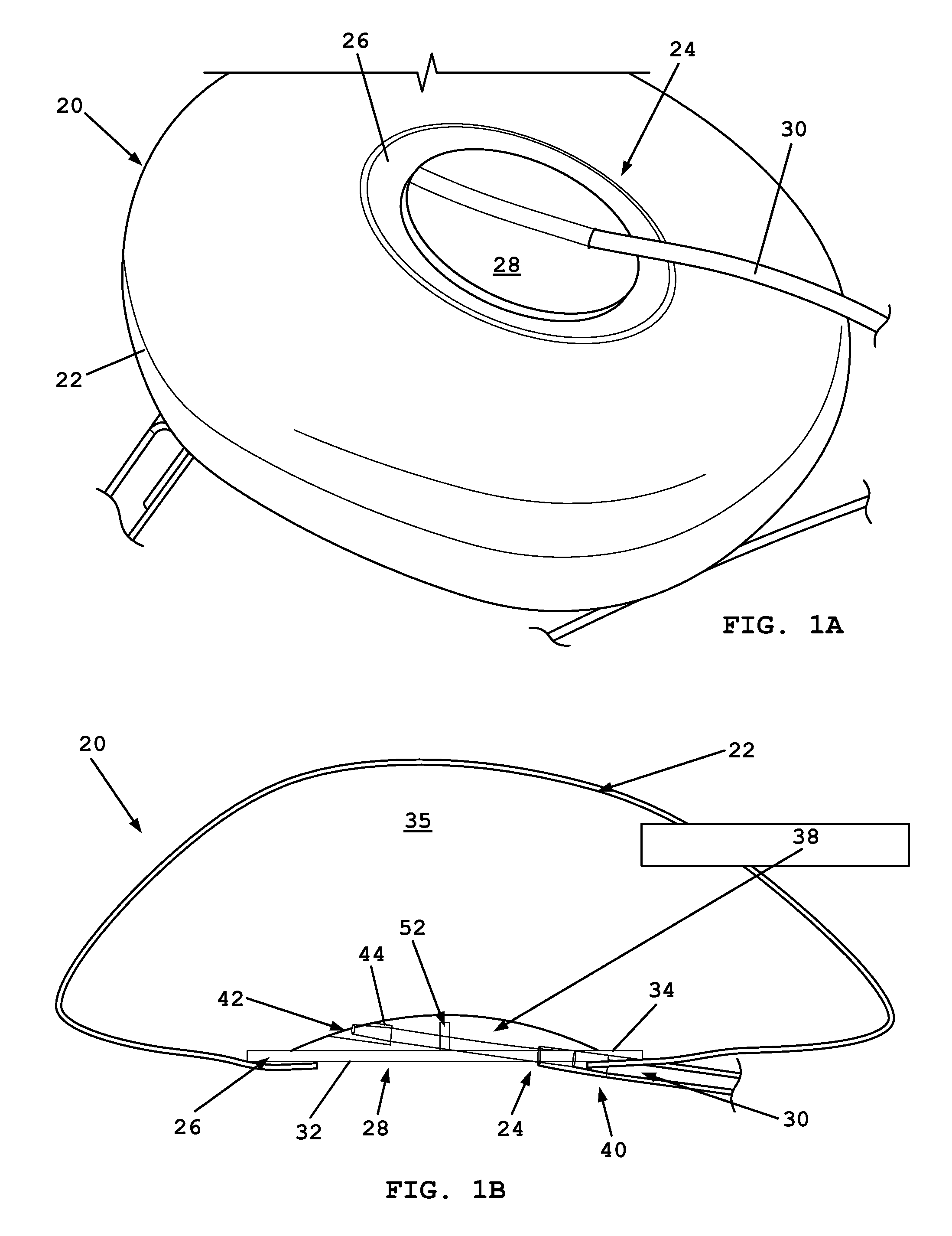 Valve assemblies for expandable implants and tissue expanders