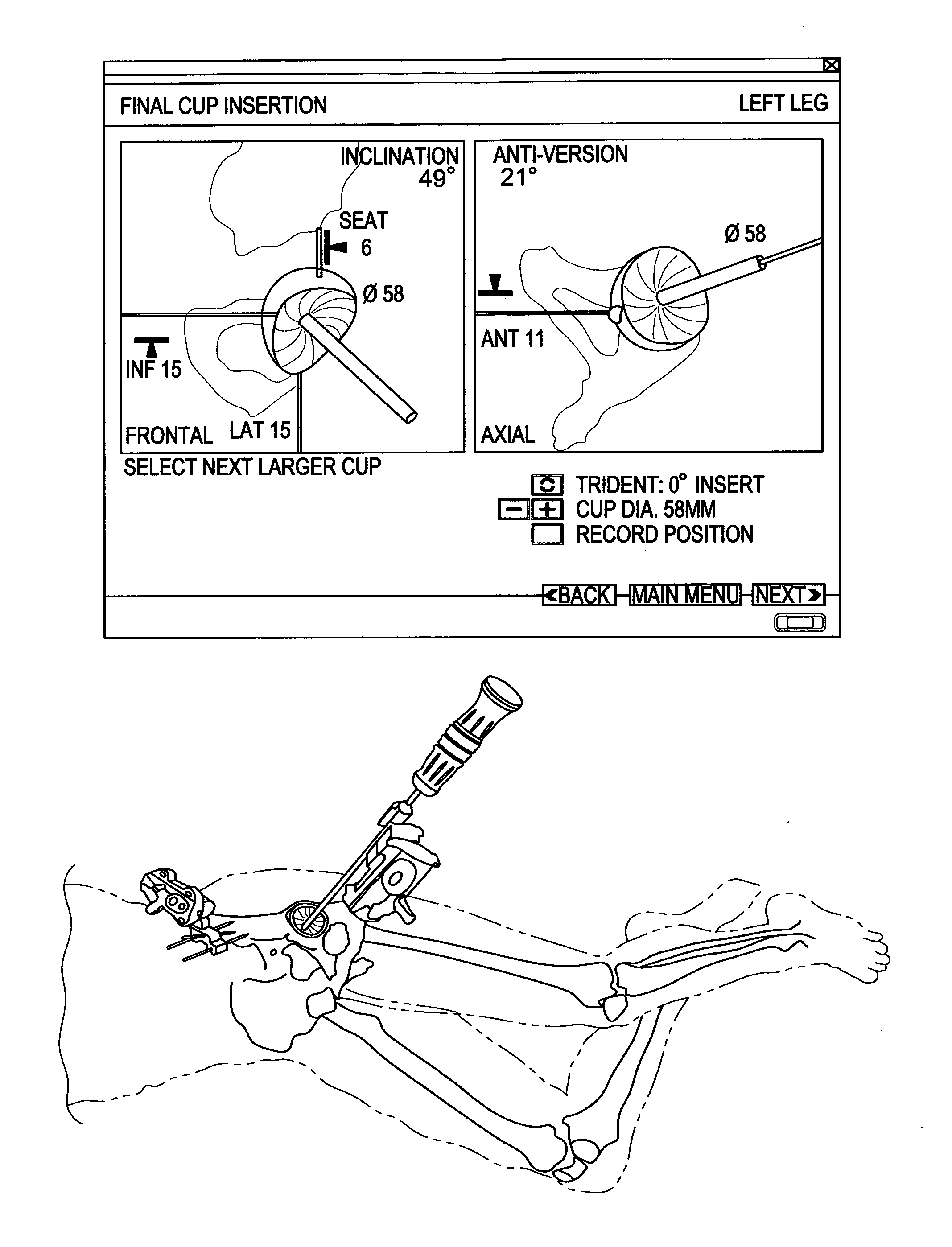 Orthopaedic Safety System