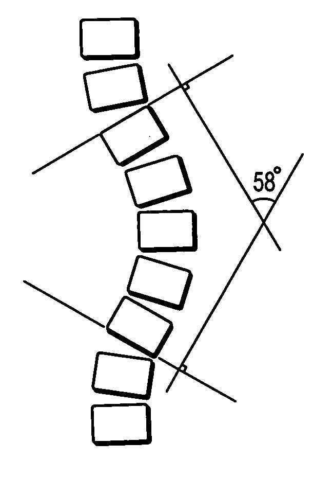 Systems and methods for computer aided detection of spinal curvature using images and angle measurements