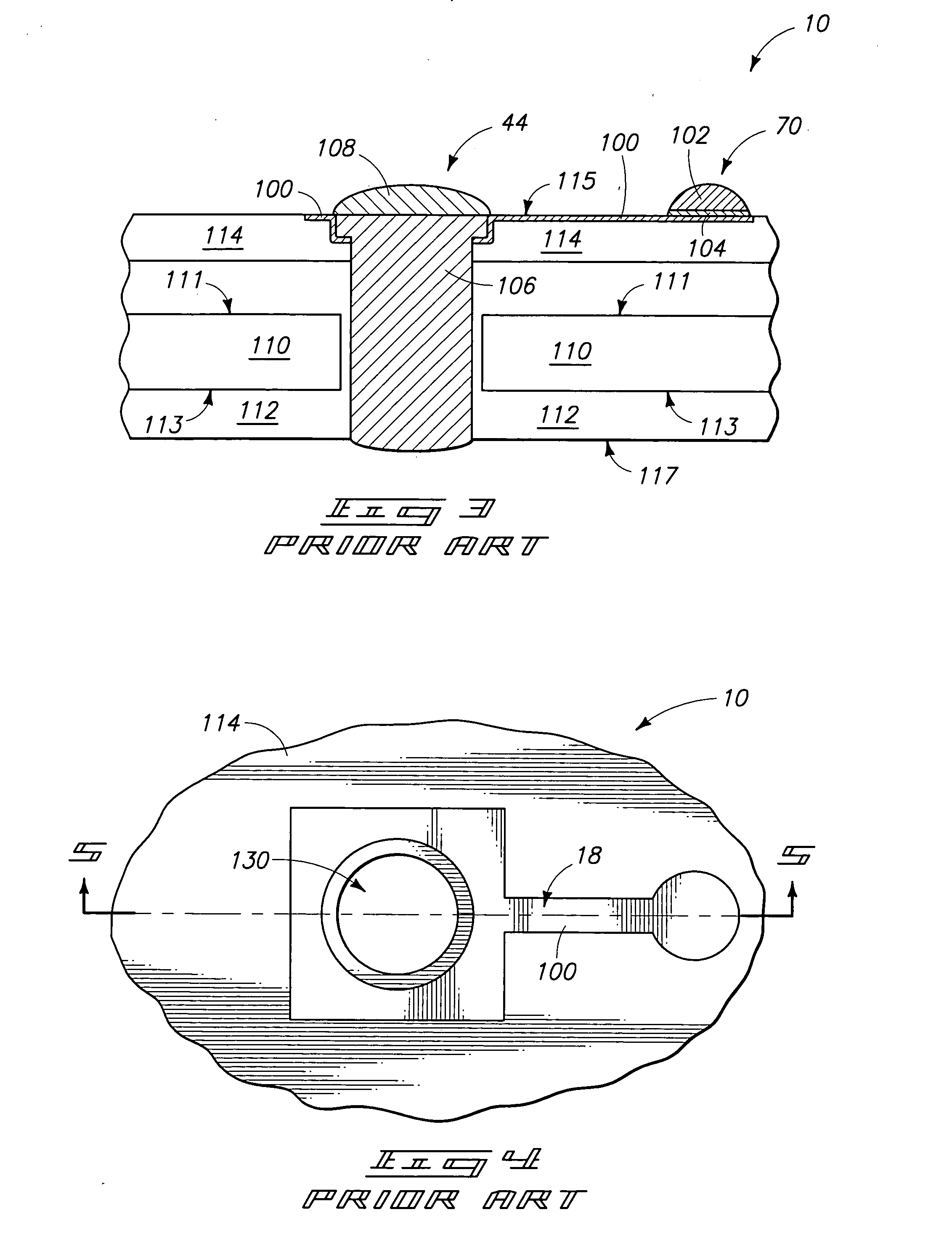 Methods of fabricating interconnects for semiconductor components