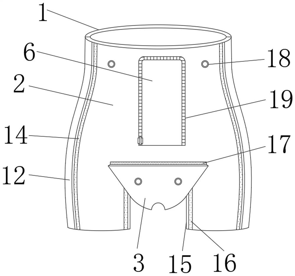 Pelvis volume control external fixation device