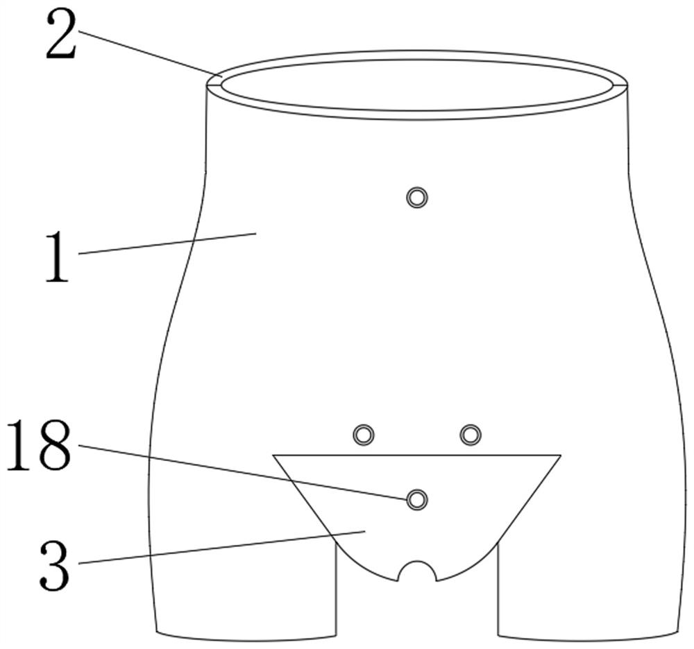 Pelvis volume control external fixation device