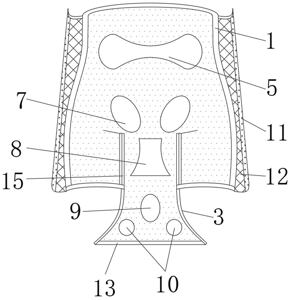 Pelvis volume control external fixation device