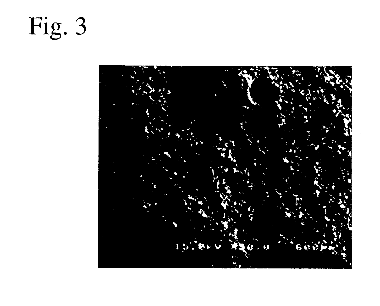 Calcium phosphate cement composition and its kit for bone prosthesis