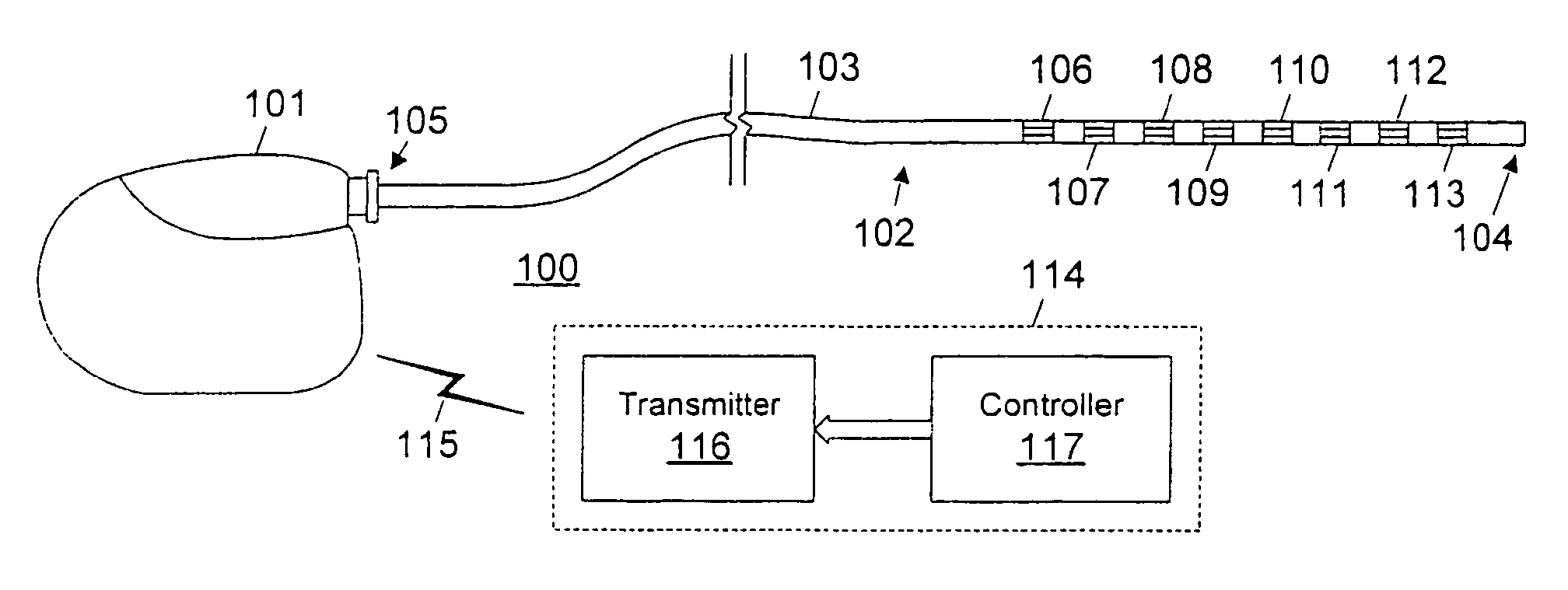 Active discharge systems and methods