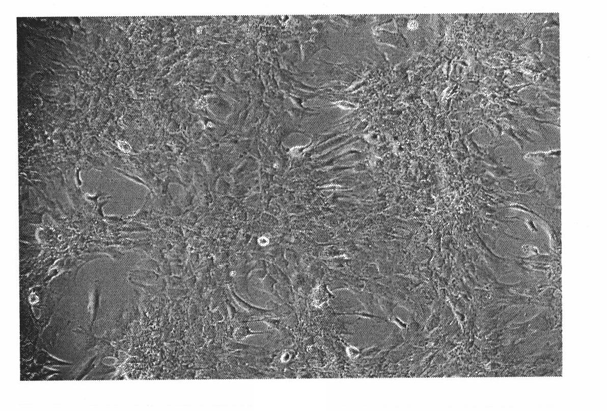 Human osteosarcoma cell strain and application thereof