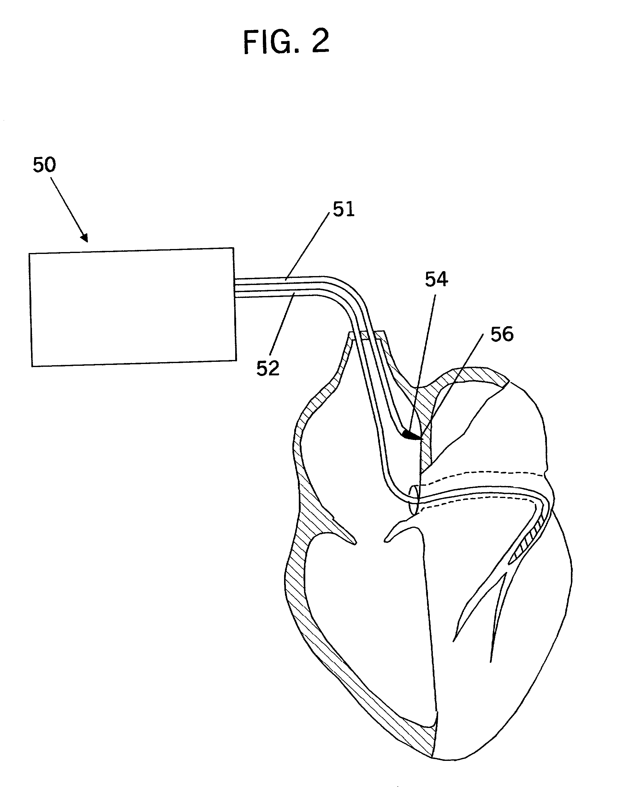 Inter-atrial septum or superior vena cava electrodes for atrial defibrillation