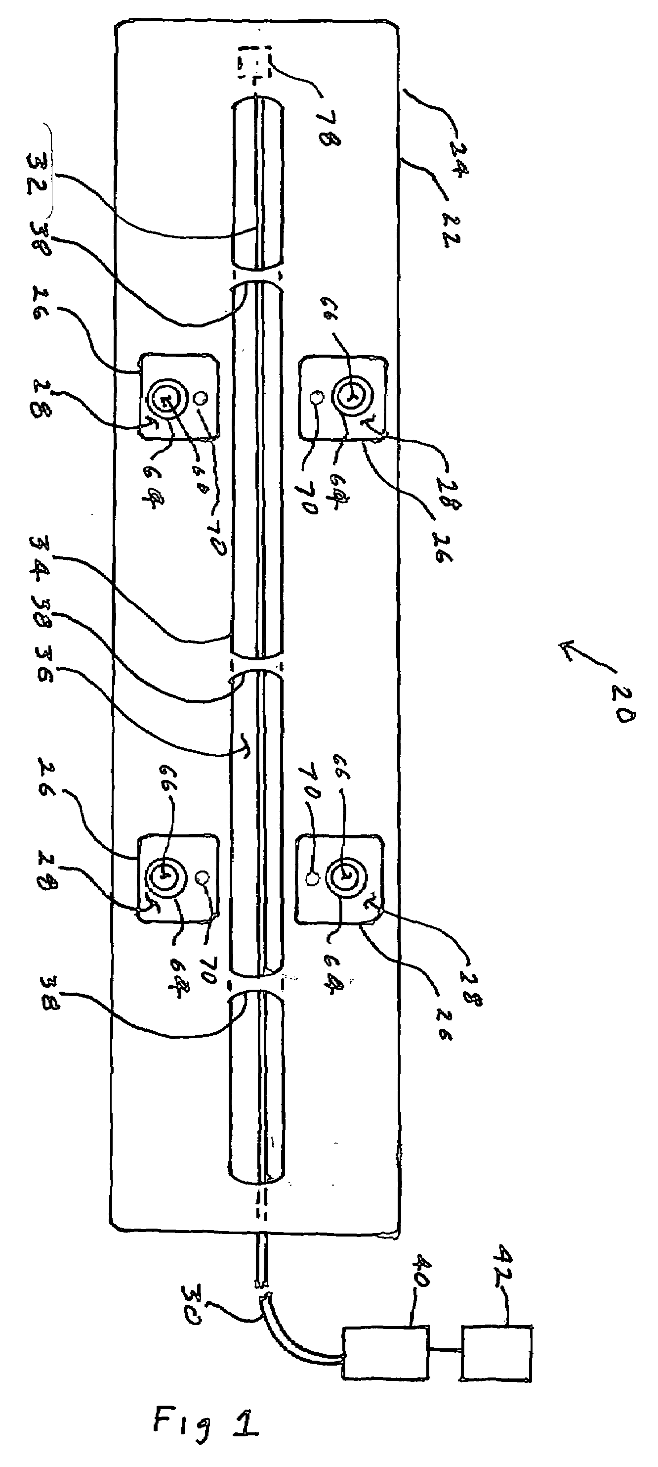 Fiber optic tissue ablation