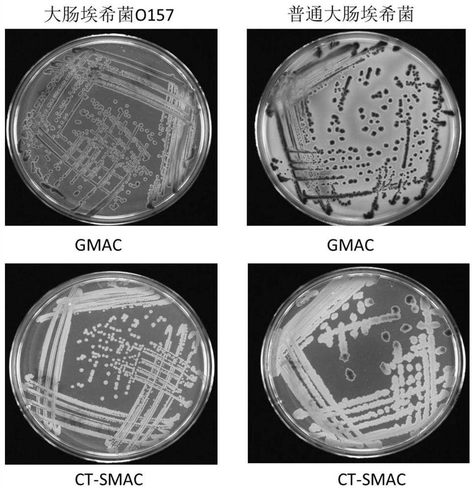 Isolation medium for detecting Escherichia coli O157 and preparation method thereof