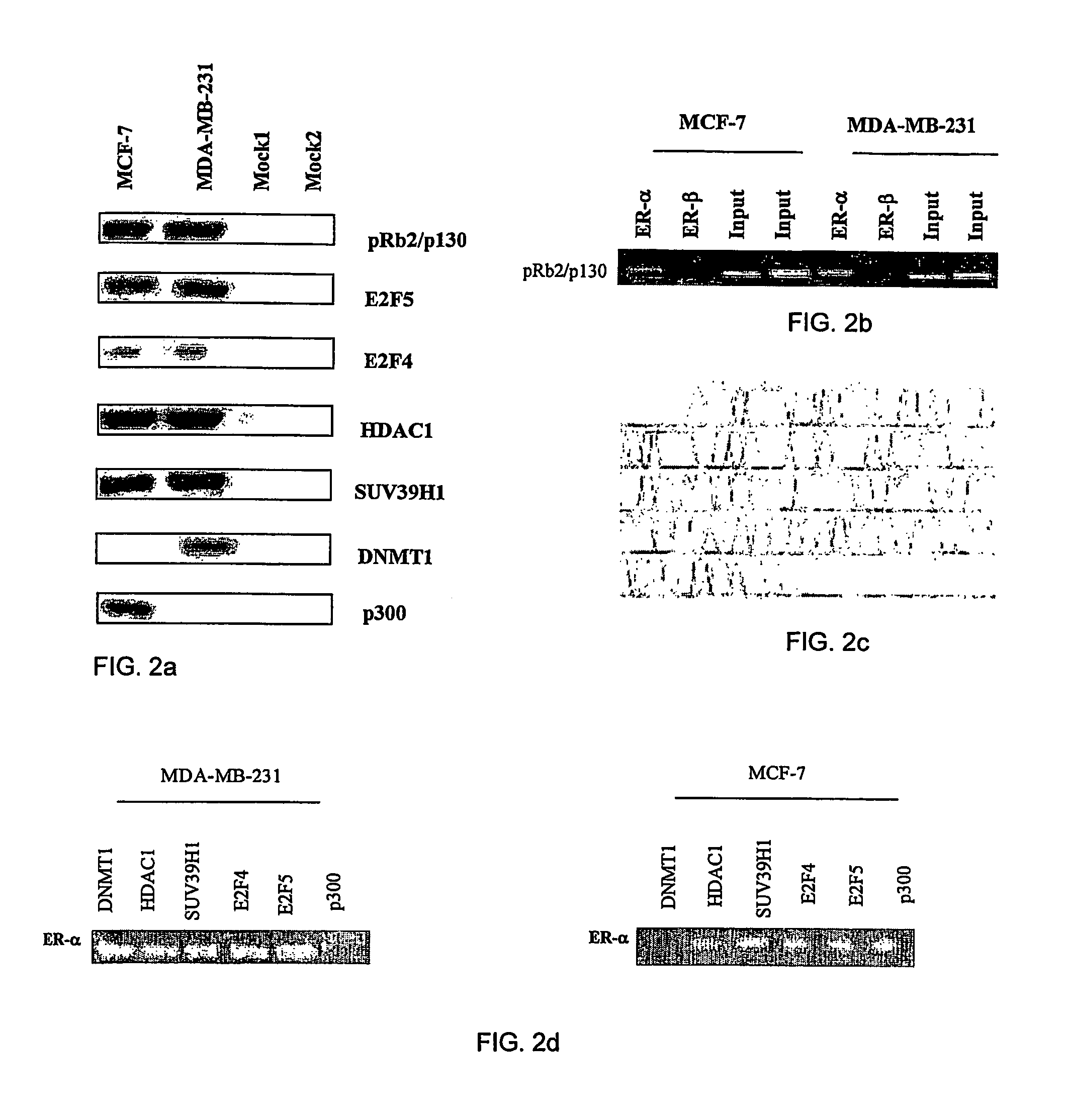 Methods of diagnosing, prognosing and treating breast cancer