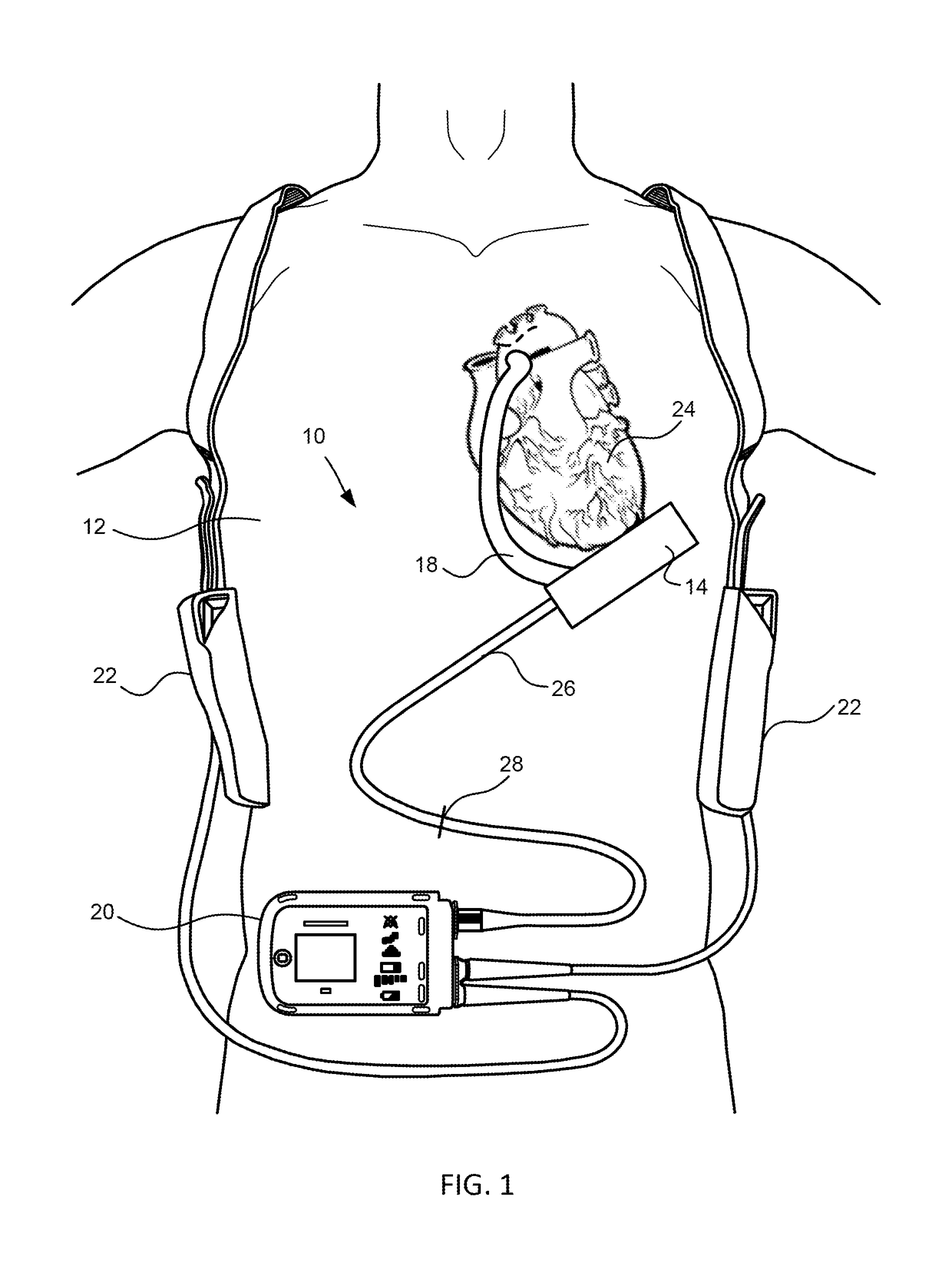 Cantilevered rotor pump and methods for axial flow blood pumping