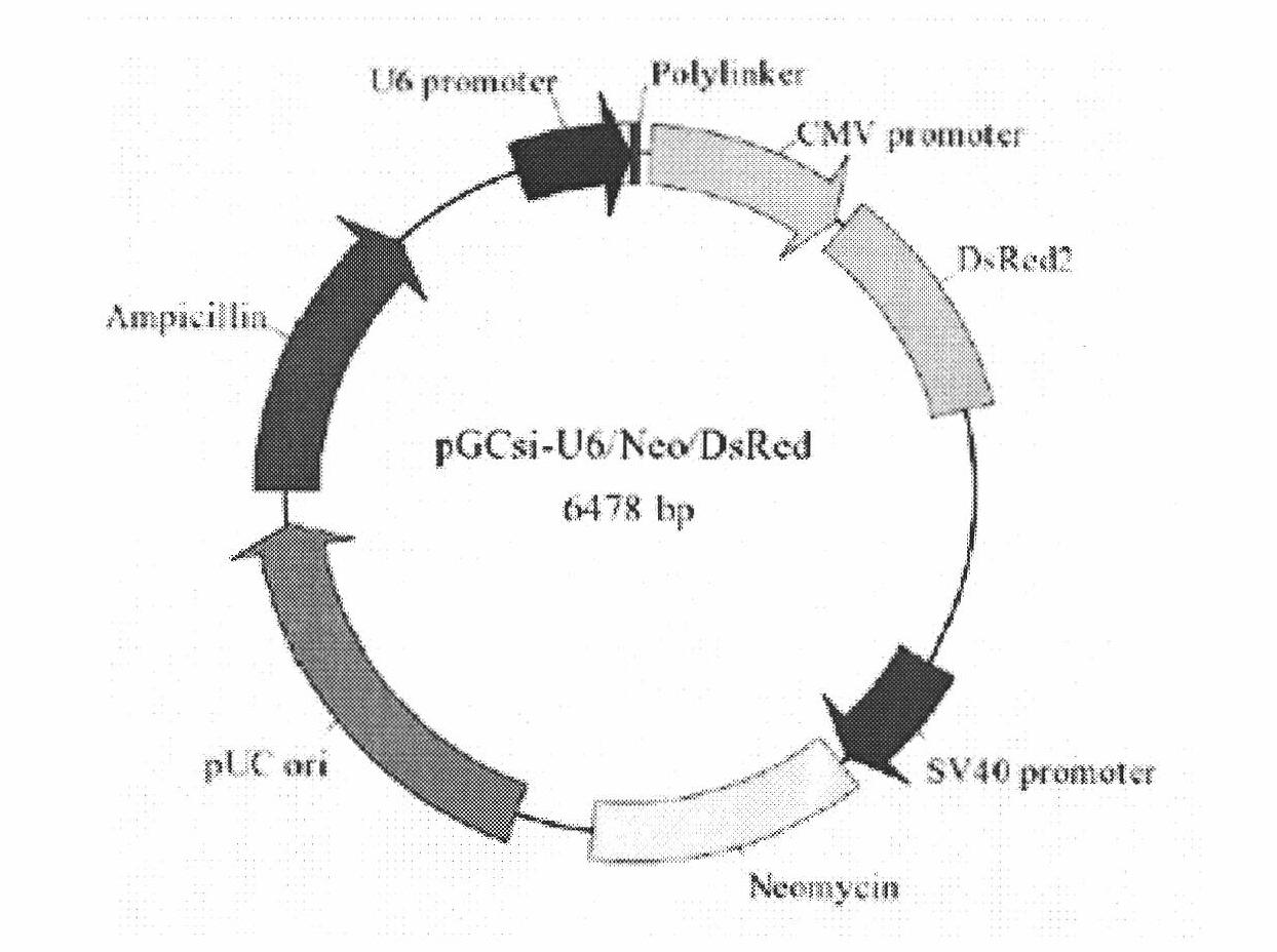 Construction and application of farnesyl pyrophosphoric acid synthetase RNA (Ribonucleic Acid) interference recombinant lentivirus vector