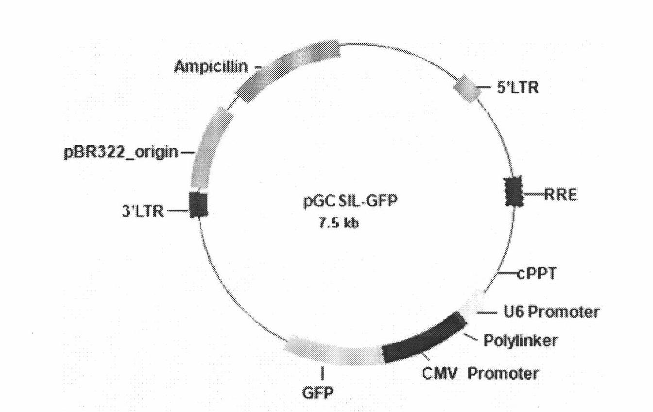 Construction and application of farnesyl pyrophosphoric acid synthetase RNA (Ribonucleic Acid) interference recombinant lentivirus vector