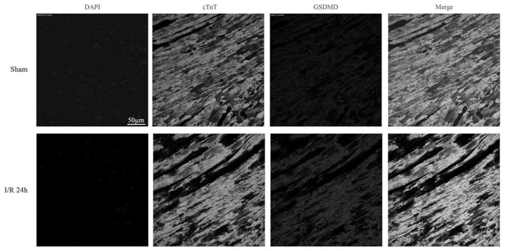 Application of GSDMD as early diagnosis marker of myocardial ischemia-reperfusion injury