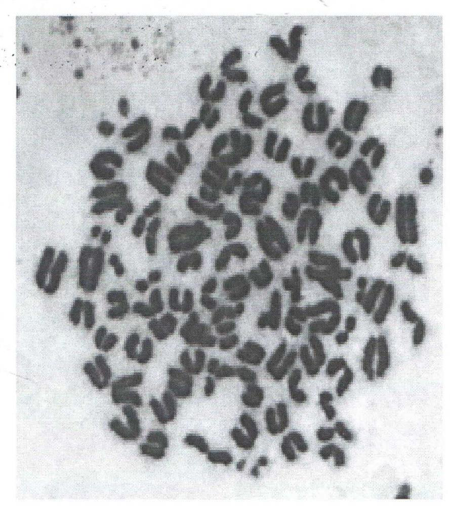 Preparation method and application of monoclonal antibody for resisting echinococcus multilocularis adult pellicle antigen