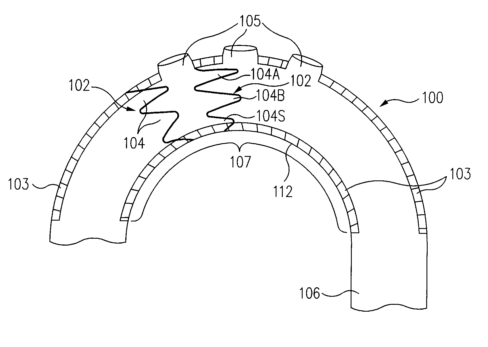 Stent Graft Tapered Spring