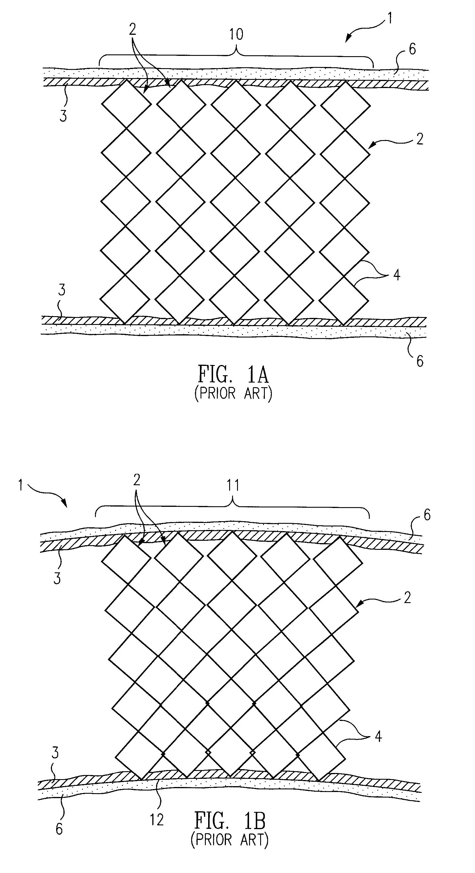 Stent Graft Tapered Spring