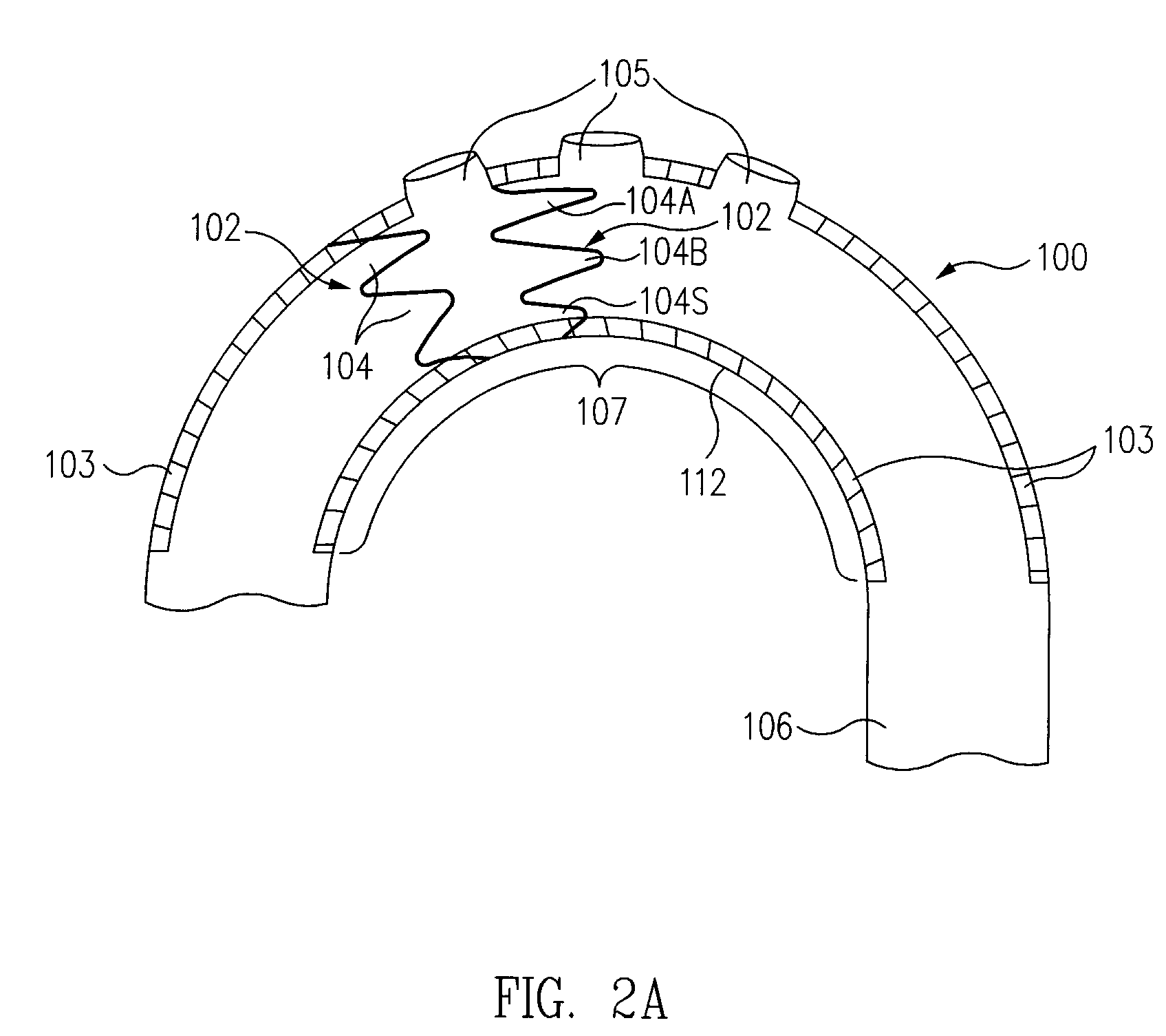 Stent Graft Tapered Spring