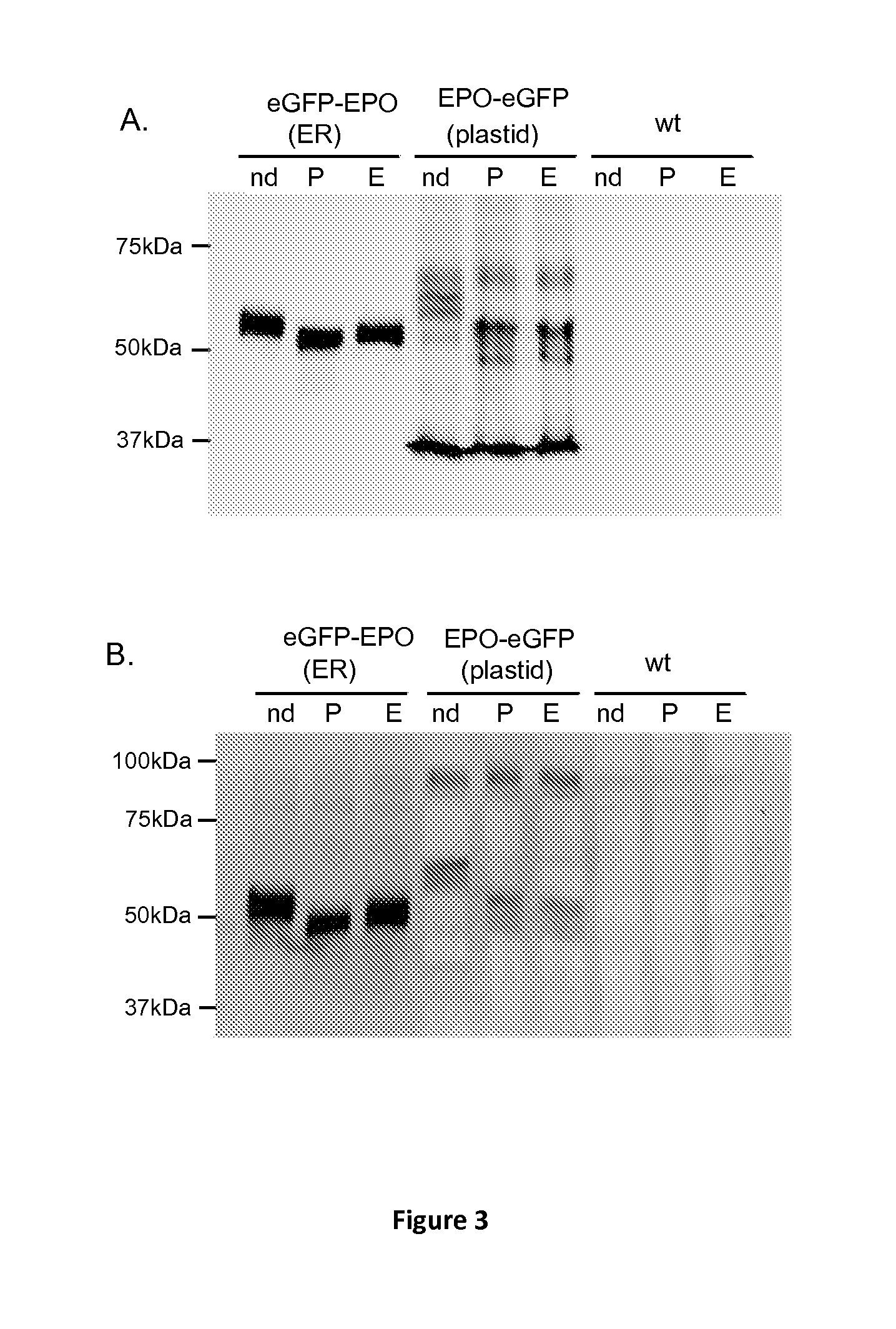 Production of high mannose glycosylated proteins stored in the plastid of microalgae