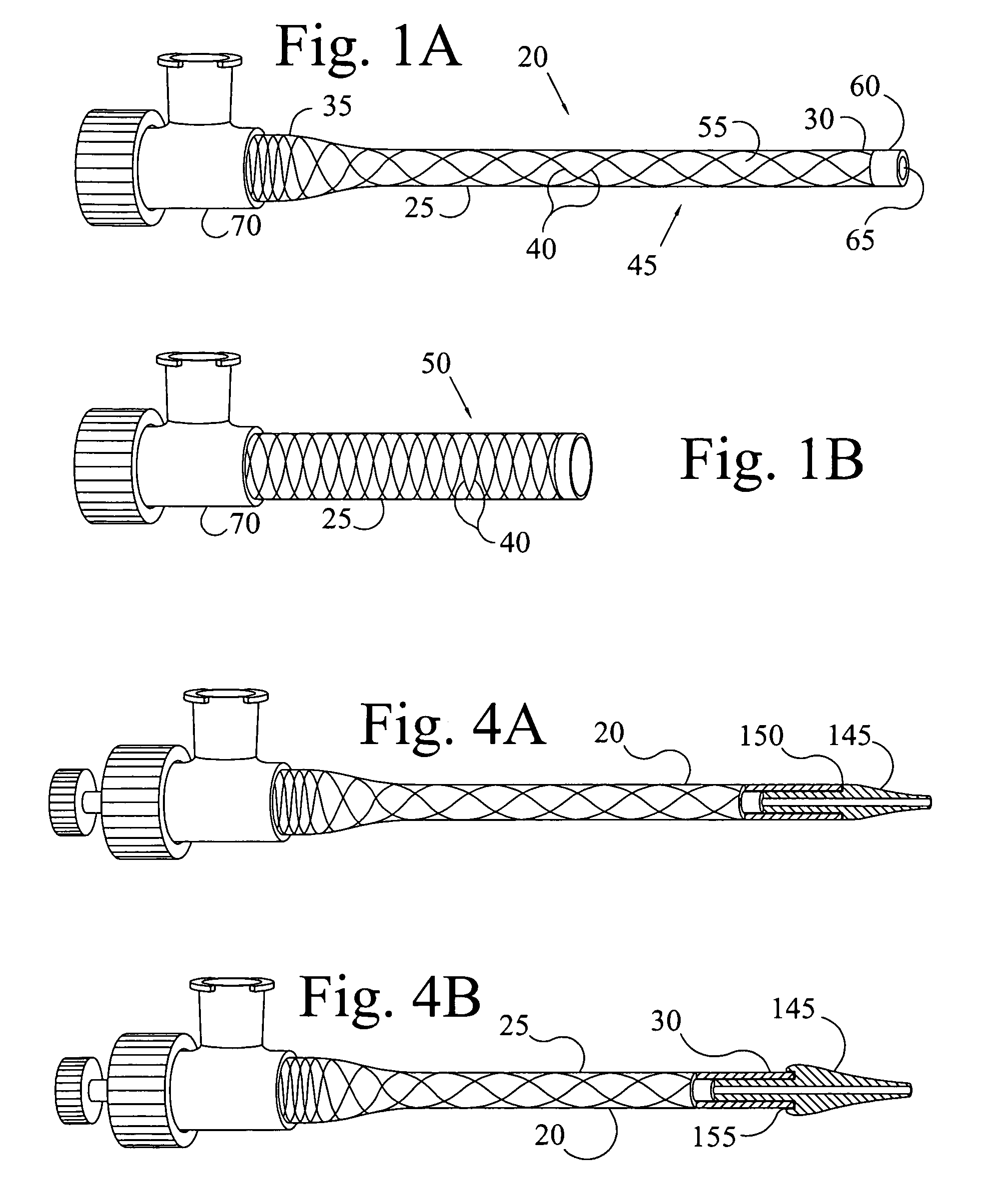 Expandable introducer sheath