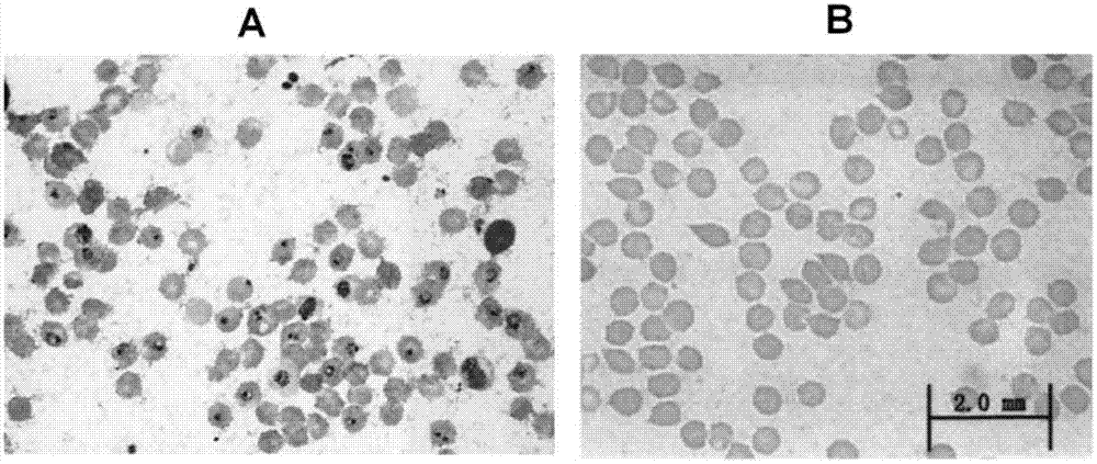 Preparation of benflumetol fat emulsion for injection and application of benflumetol fat emulsion in treatment of malaria