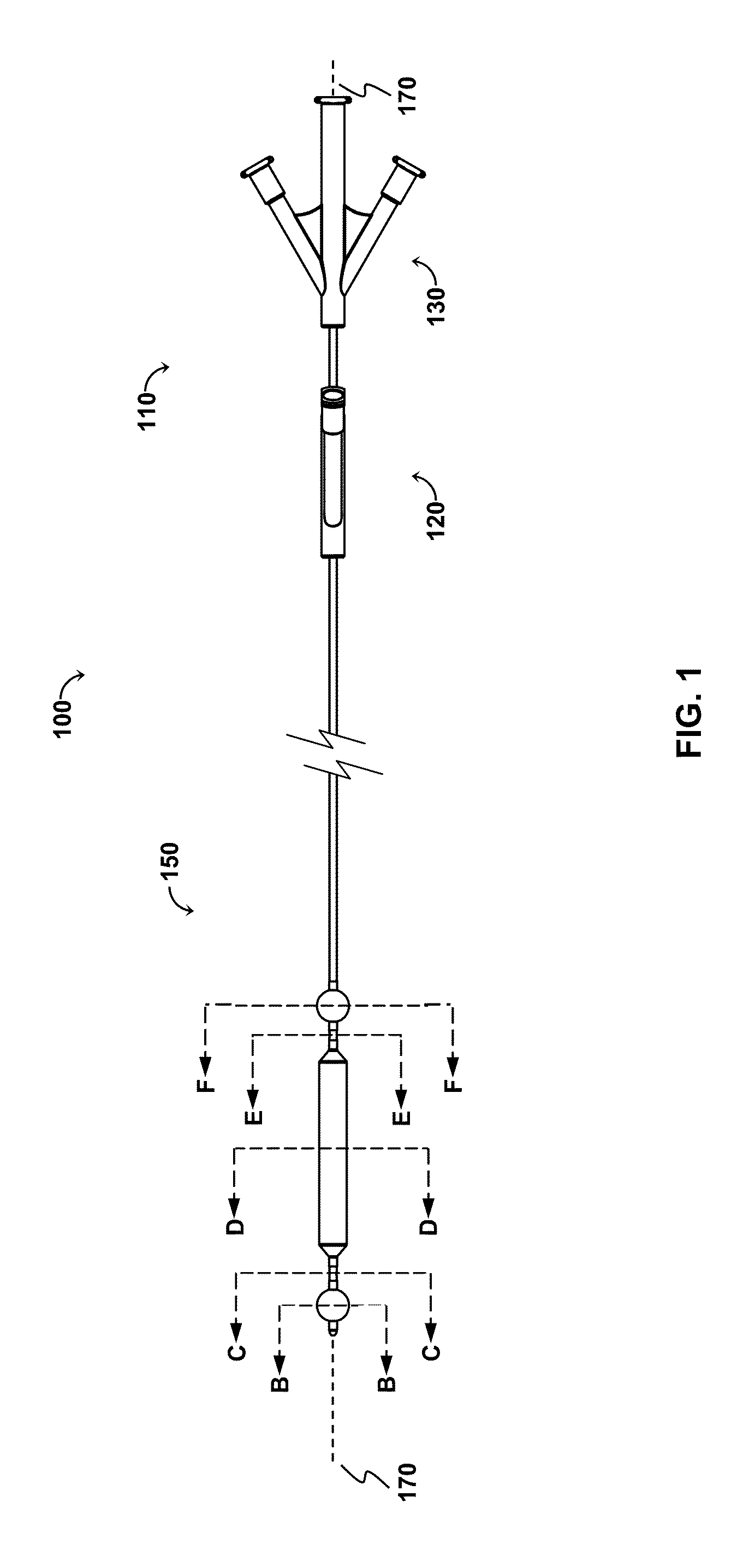 Occlusion Perfusion Catheter