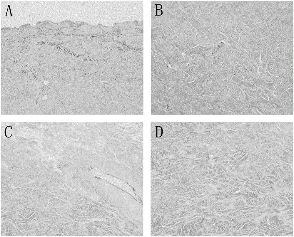 Acellular biological dermal material, and preparation method and application thereof