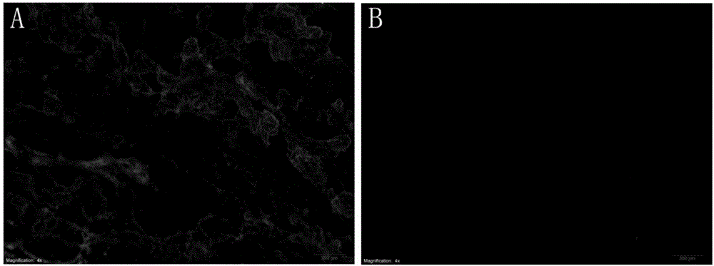 Acellular biological dermal material, and preparation method and application thereof