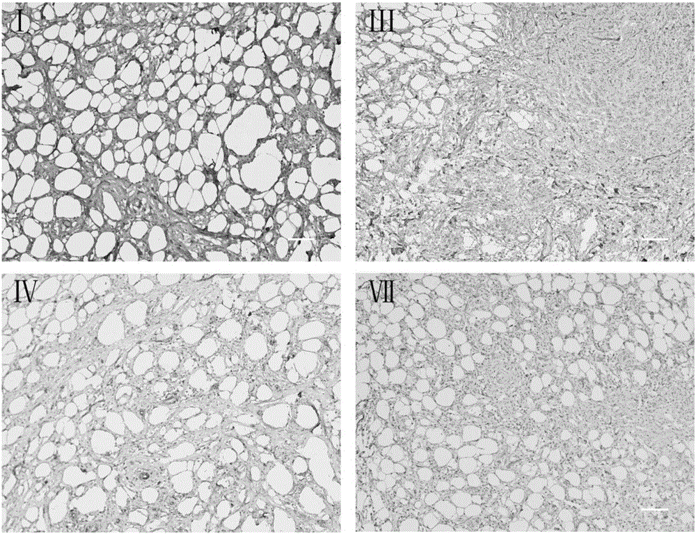 Acellular biological dermal material, and preparation method and application thereof