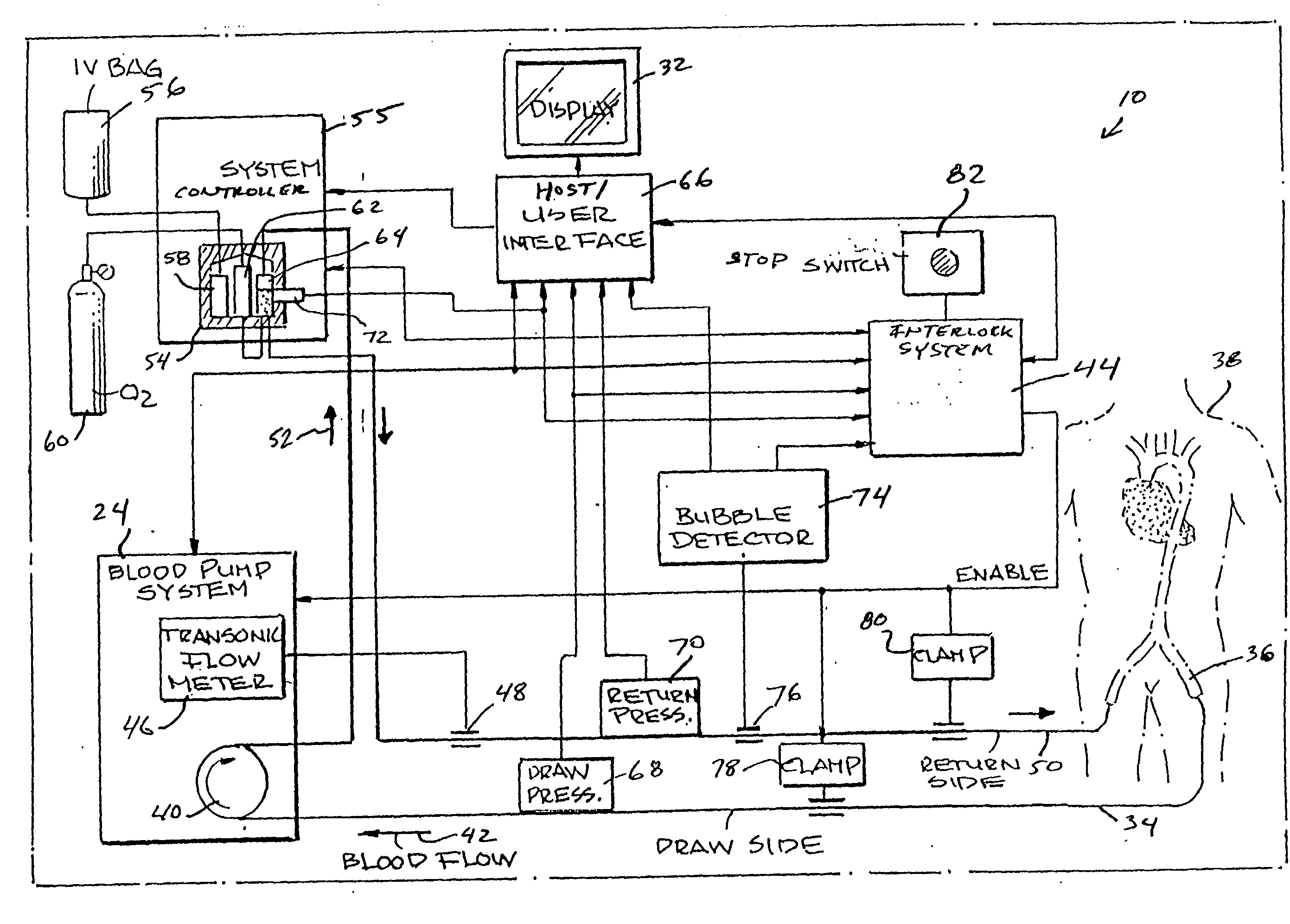 Bubble detector and method of evaluation or calibration thereof