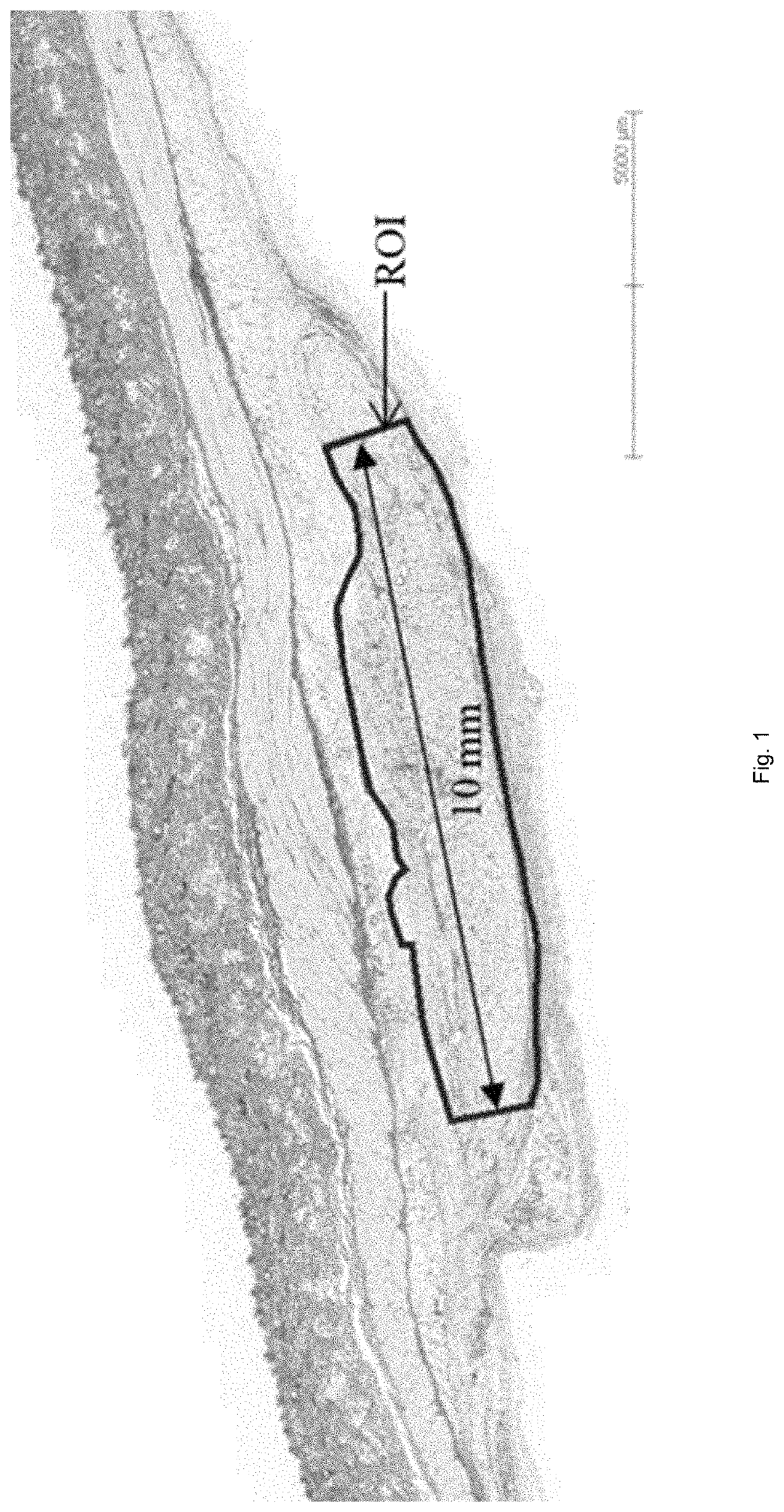 Resorbable biodegradable medical and cosmetic composition comprising poly(1,3-trimethylene carbonate)