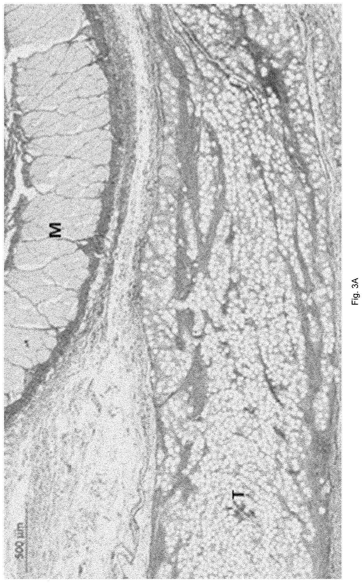 Resorbable biodegradable medical and cosmetic composition comprising poly(1,3-trimethylene carbonate)