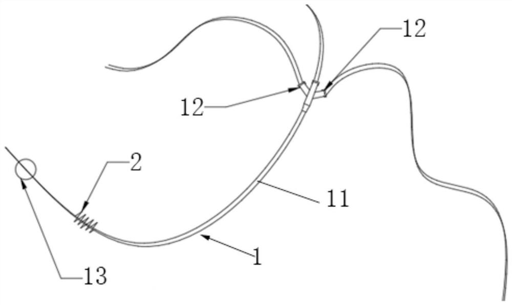 Interventional renal artery sympathetic nerve activity detection system