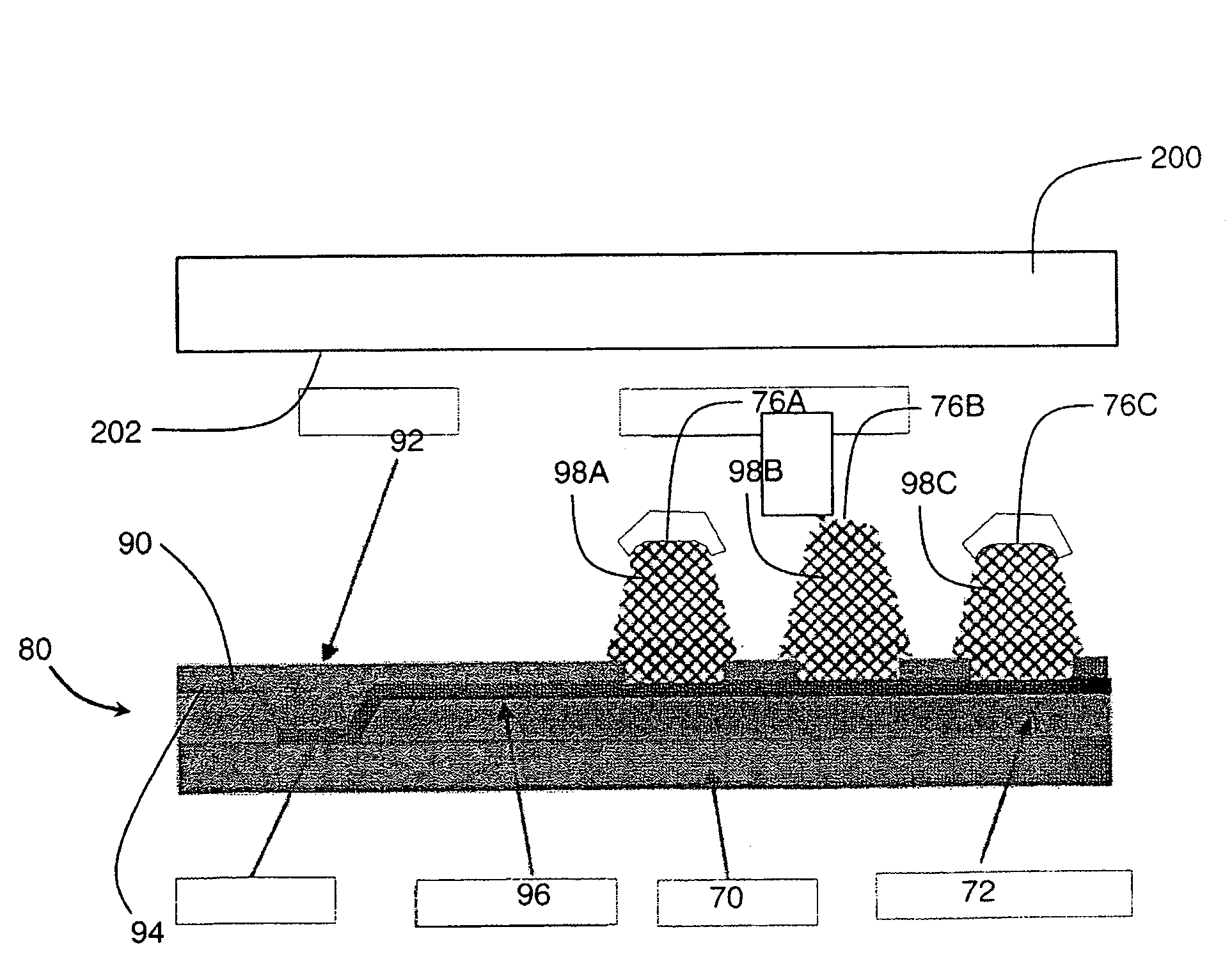 Microelectronic component with foam-metal posts