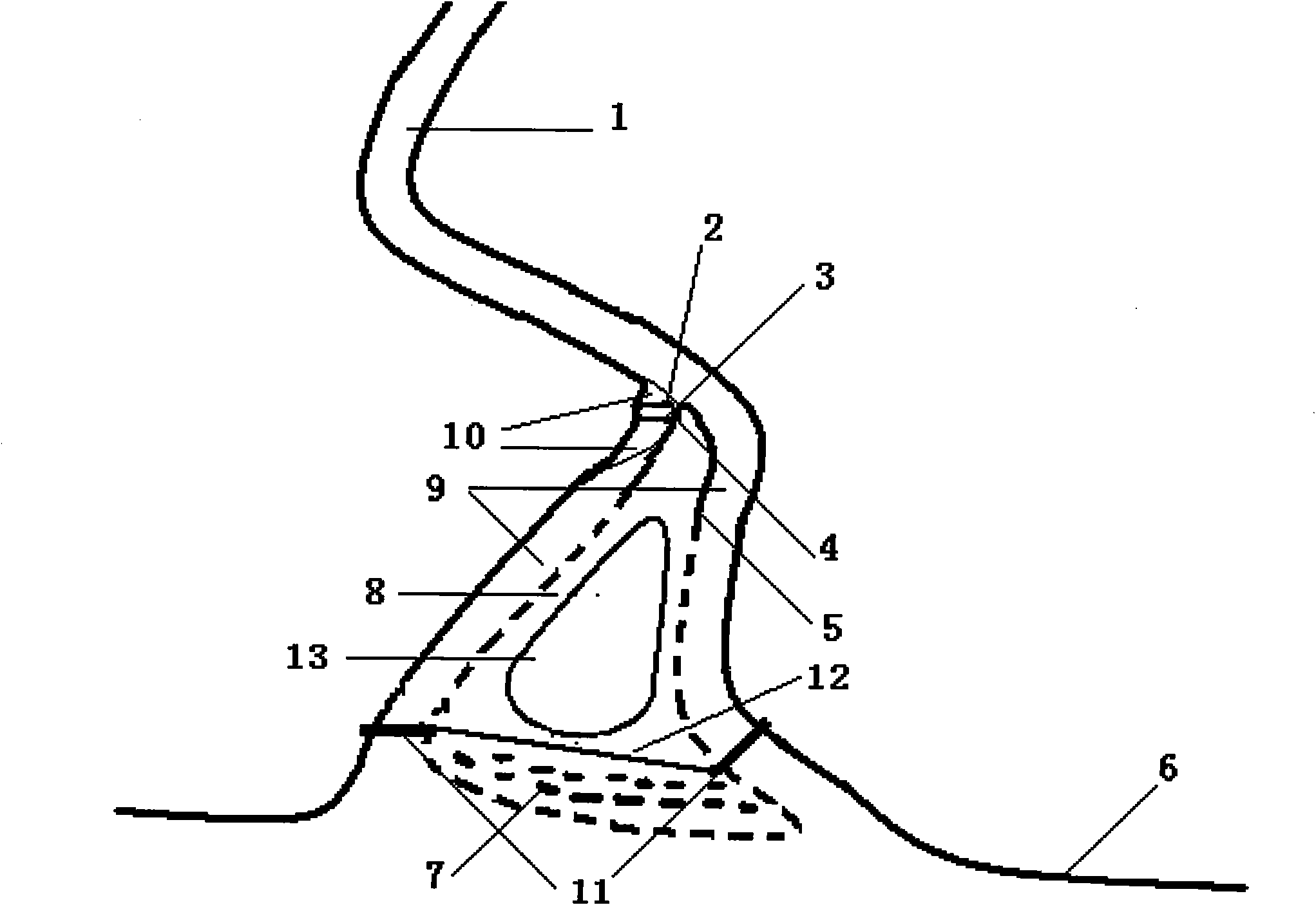 Method for treating river entrance