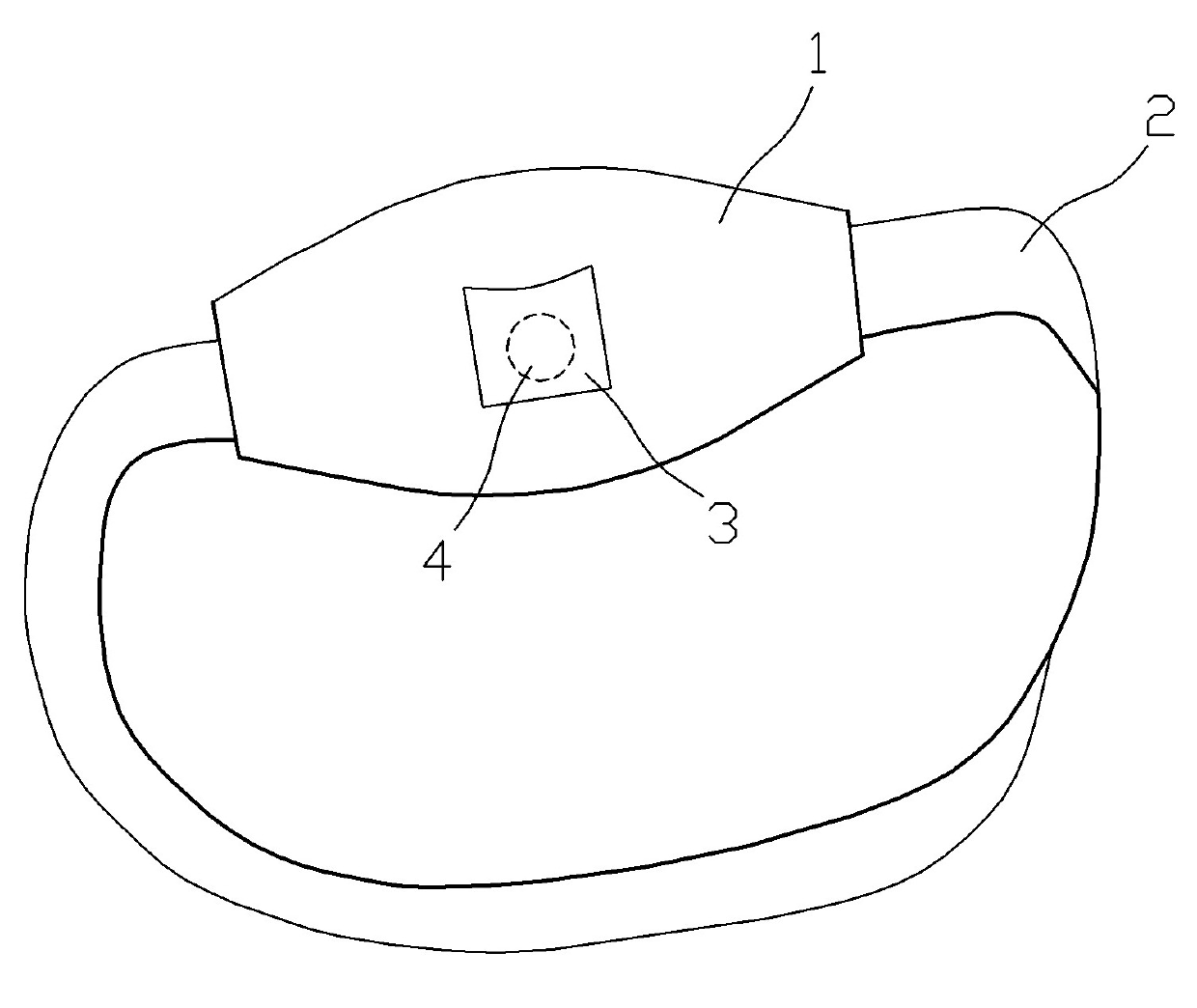 Externally applied traditional Chinese medicine composition for treating umbilical hernia and umbilical hernia treating bag containing lychee seed and rhizoma cimicifugae