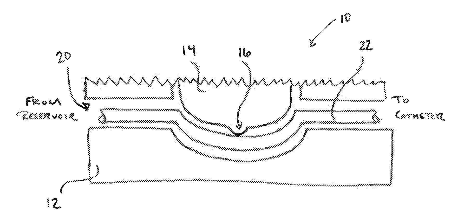 Devices and Methods for Reducing Electrical Noise in an Irrigated Electrophysiology Catheter System