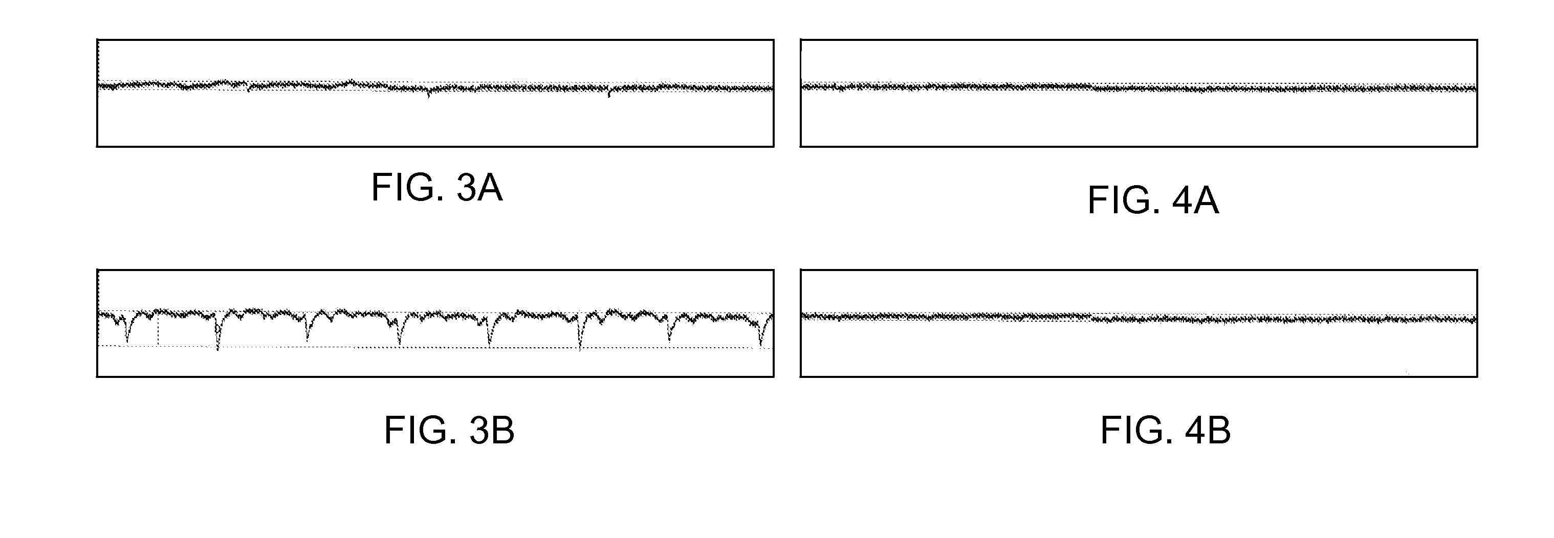 Devices and Methods for Reducing Electrical Noise in an Irrigated Electrophysiology Catheter System