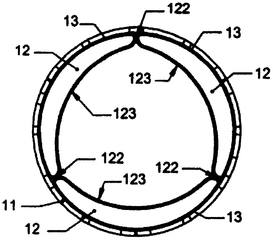 Invasive prosthetic heart valve