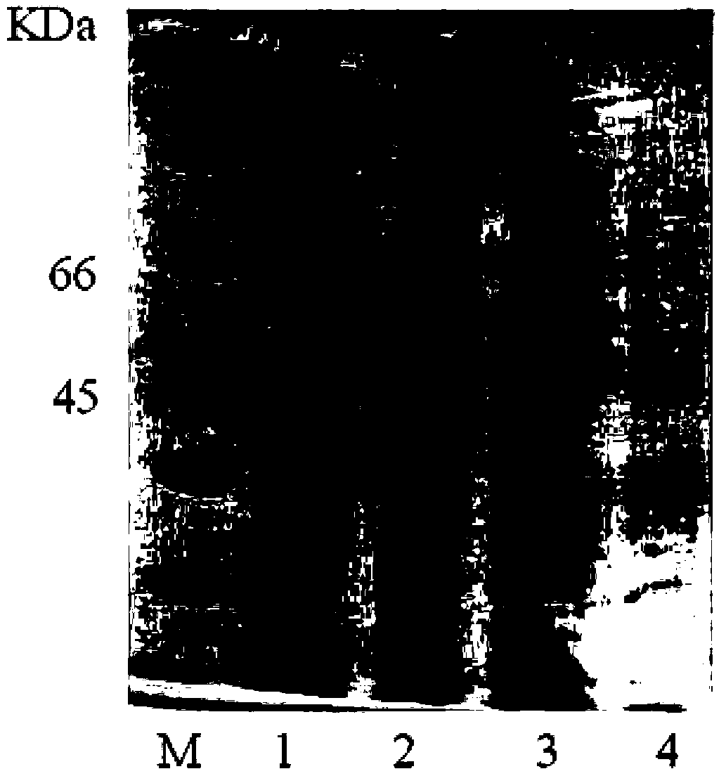 (+)Gamma-lactamase, its coding gene and application