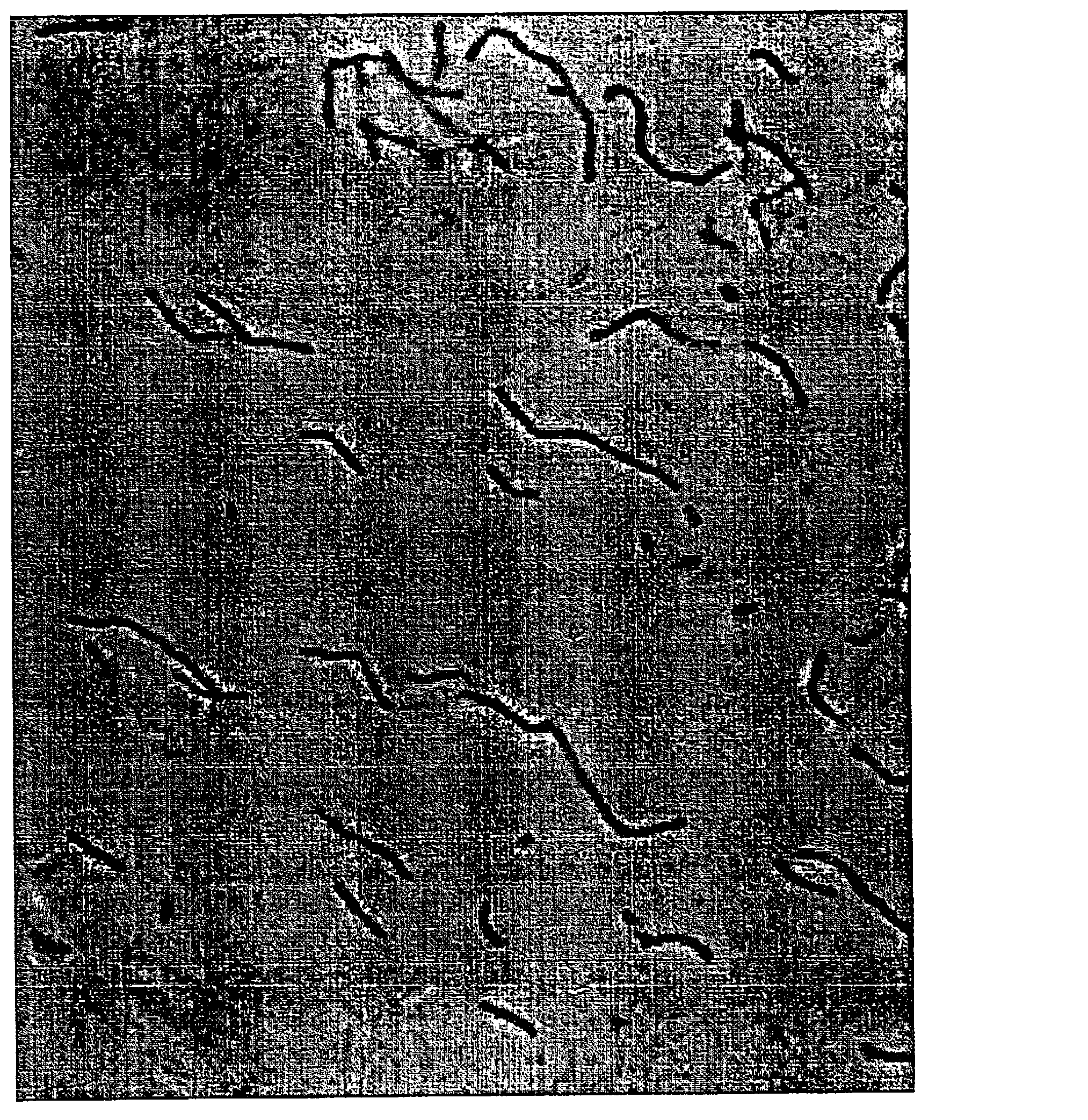 Novel lactobacilli and composition thereof, and application thereof in preparing medicines used for ameliorating diabetes and complications thereof