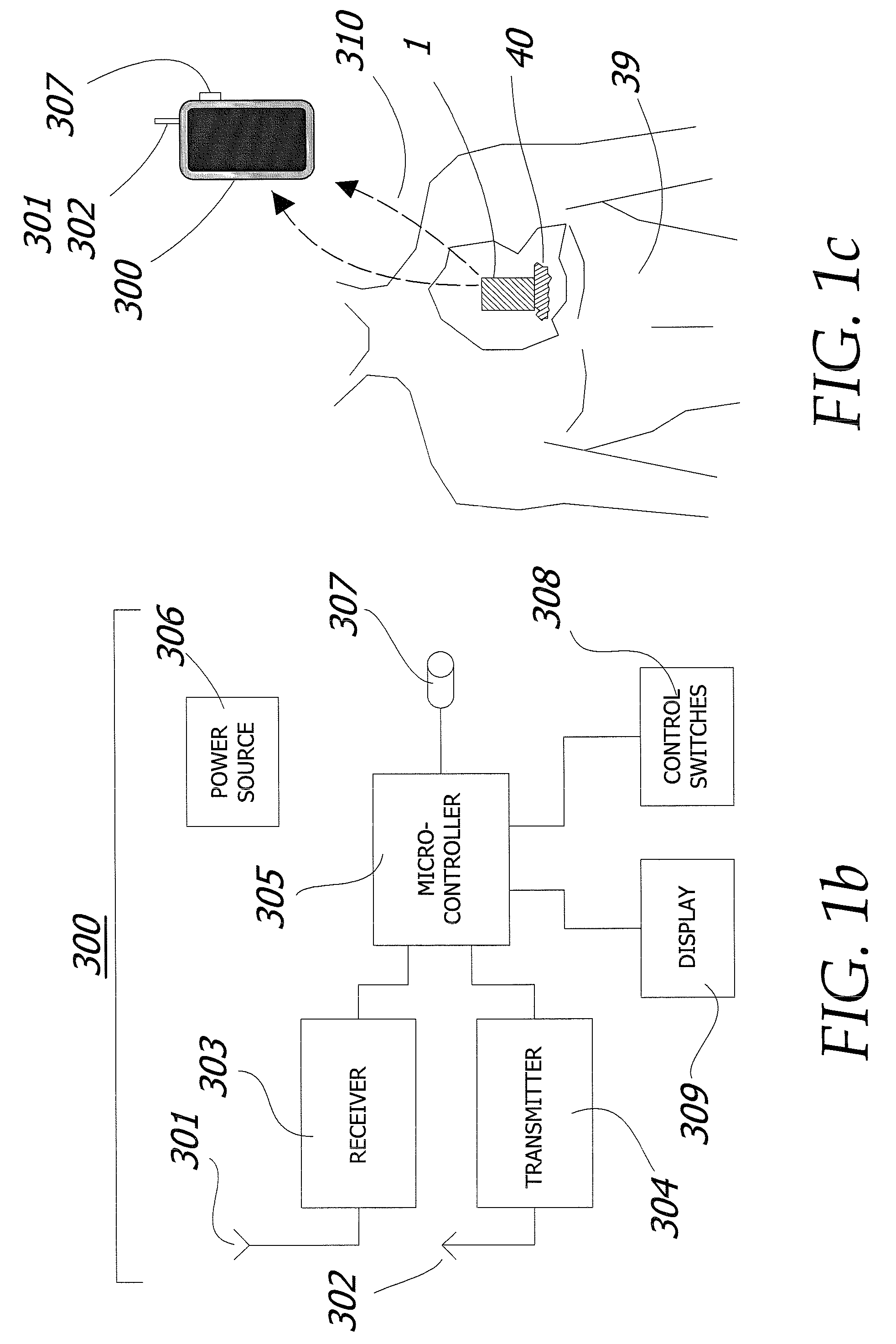 Magnetic Breather Pump and a Method for Treating a Brain Tumor Using the Same