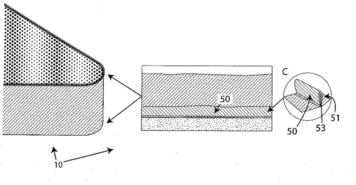 Mattress protector with removable top and having side supports