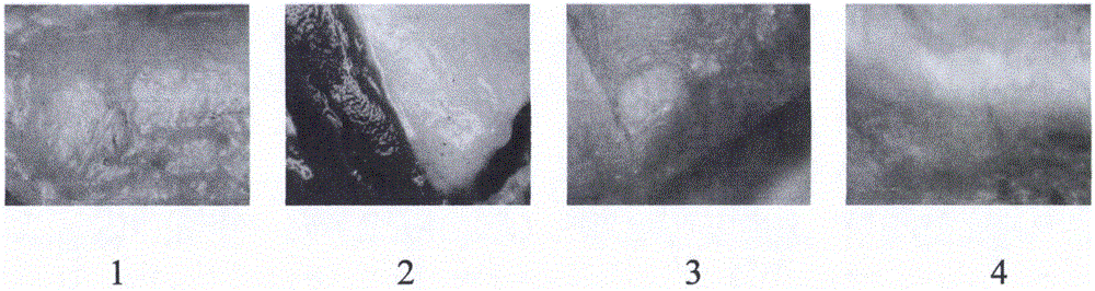 Pharmaceutical composition for treating atherosclerosis and application thereof