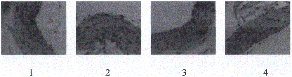 Pharmaceutical composition for treating atherosclerosis and application thereof