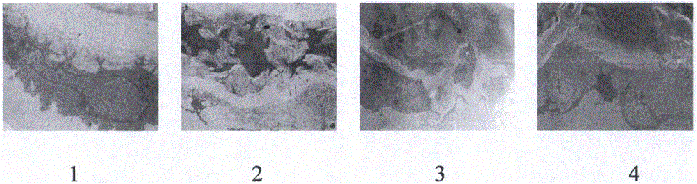 Pharmaceutical composition for treating atherosclerosis and application thereof