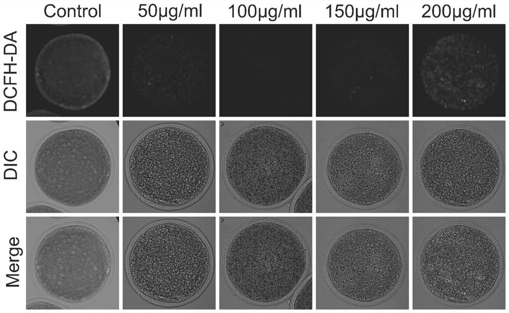 Oocyte in-vitro maturation culture solution additive and application thereof