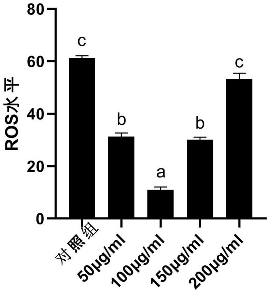 Oocyte in-vitro maturation culture solution additive and application thereof