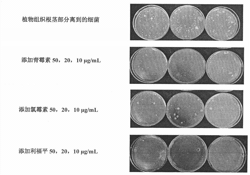 Medium for simple, convenient and quick pythium aphanidermatum isolation